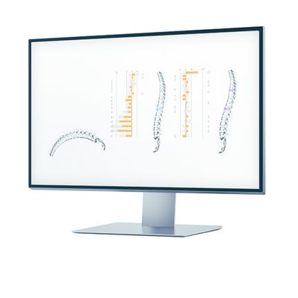 IDIAG M360 sugárzásmentes 3D gerinc-scanner